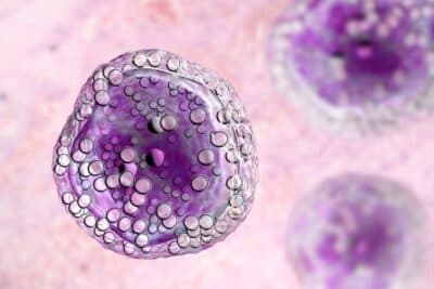 Linfoma B: España lidera un ensayo clínico que personaliza el tratamiento