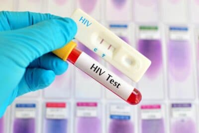 VIH: la OMS incorpora la terapia doble en sus guías de tratamiento