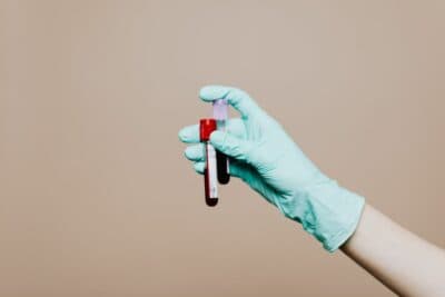 La OMS clasifica la hepatitis D como cancerígena