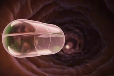Una cápsula detecta inflamación intestinal con un simple cambio de color