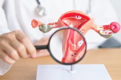 Câncer de ovário: Anvisa aprova novo tratamento para casos resistentes à quimioterapia