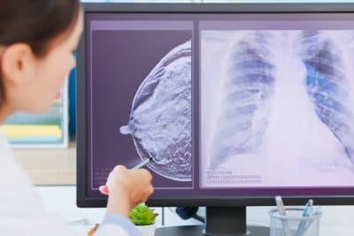 Nuevas estrategias en la investigación del cáncer de mama