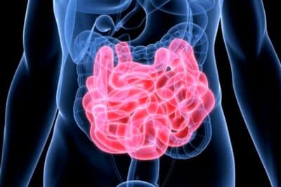 Diferencia entre enfermedad de Crohn y colitis ulcerosa: síntomas, causas y tratamiento