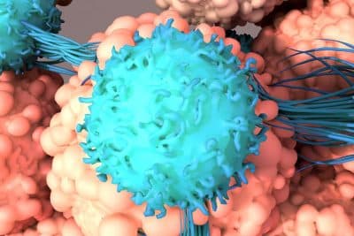 La inmunoterapia como alternativa en el cáncer de vejiga