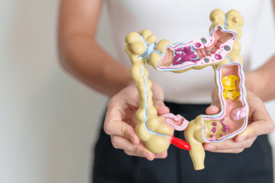 Consejos para pacientes con cáncer de colon antes de la cirugía