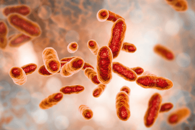 Efectos de la vaginosis bacteriana en embarazadas adolescentes